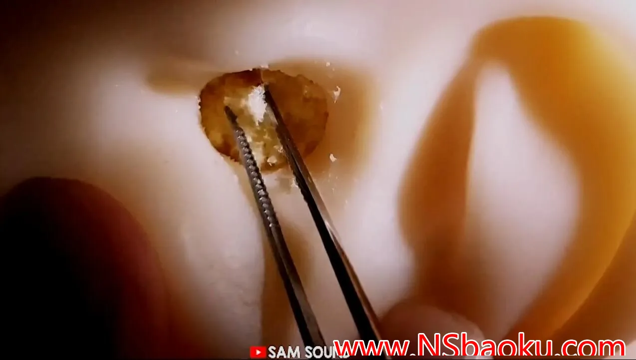 口腔与掏耳交织——沉浸式感官盛宴