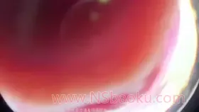 晚安yoyo_剧情医生为你治疗（一）鱼眼舔屏-男士宝库